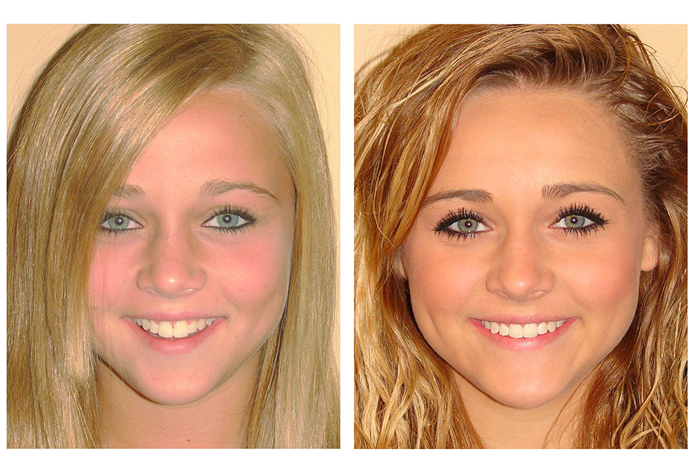 Advanced Dental Centers